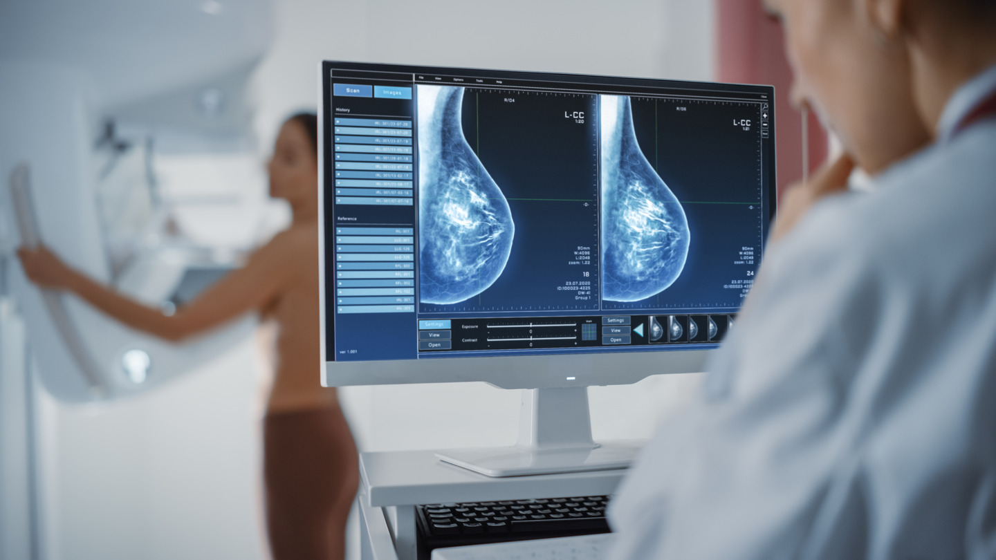 Technological developments like machine learning can improve mammogram effectiveness.
